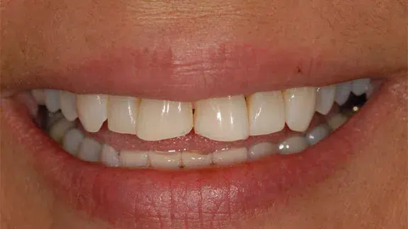 anna-case2-before.webp