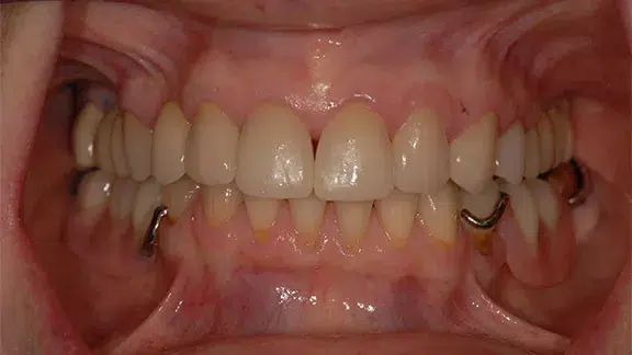 cindy-case2-after.webp