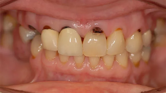 cindy-case2-before.webp