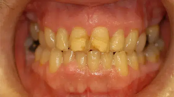 dennis-case2-before.webp