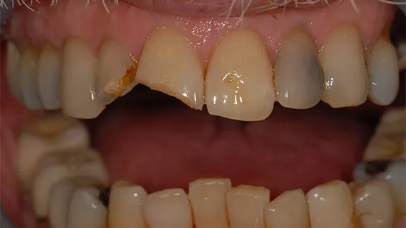 lindon-case2-before.webp