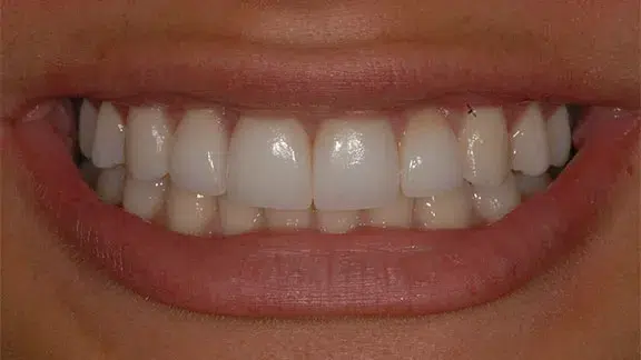madison-case3-after.webp