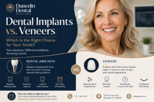 Dunedin Dental Associates feature image comparing dental implants vs. veneers for missing teeth, cosmetic smile improvement, and personalized dental care in Dunedin.