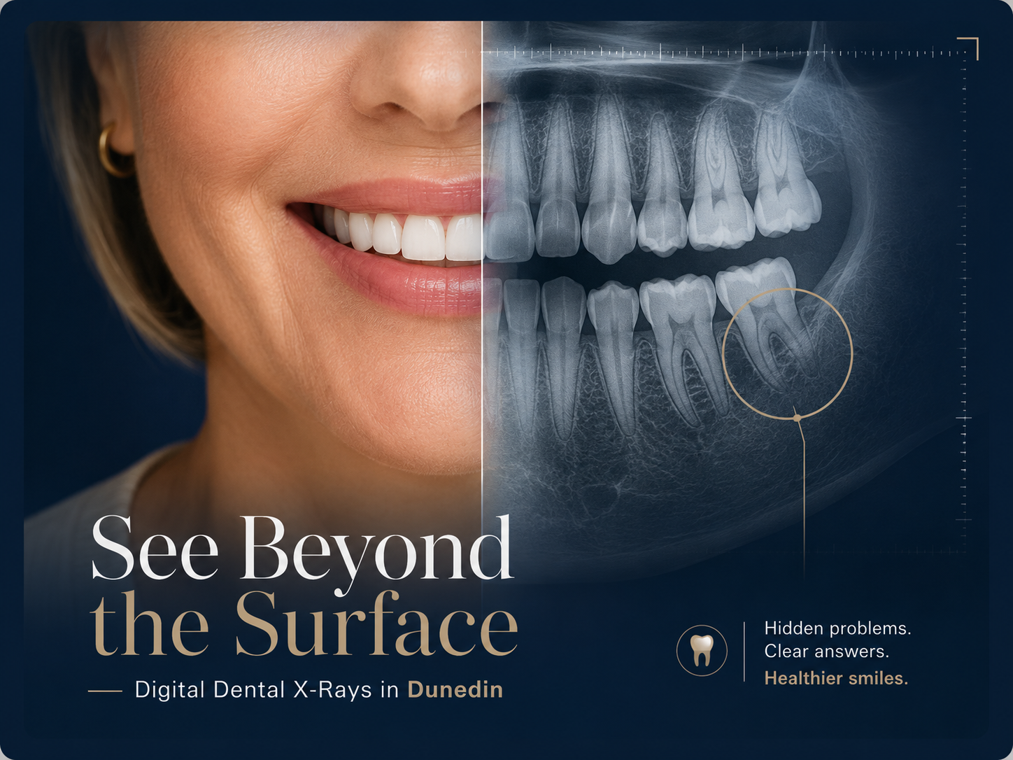 Digital dental X-rays showing hidden problems beneath the surface of a smile