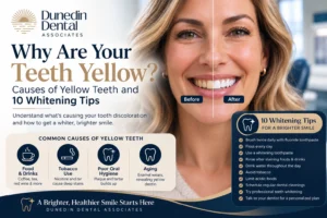 Why are your teeth yellow infographic showing common causes of yellow teeth, whitening tips, and a before-and-after teeth whitening comparison from Dunedin Dental Associates